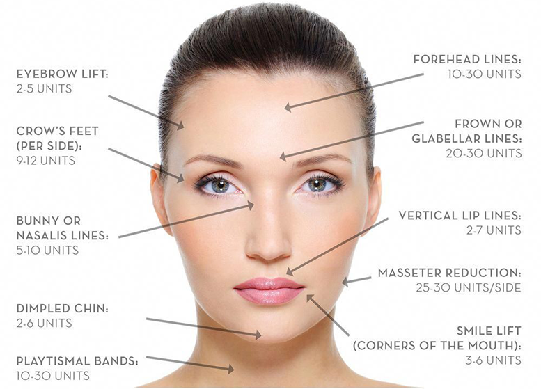 Botox near me in Laval Quebec