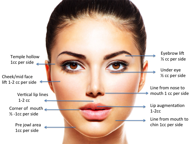 dermal fillers laval, lip augmentation laval