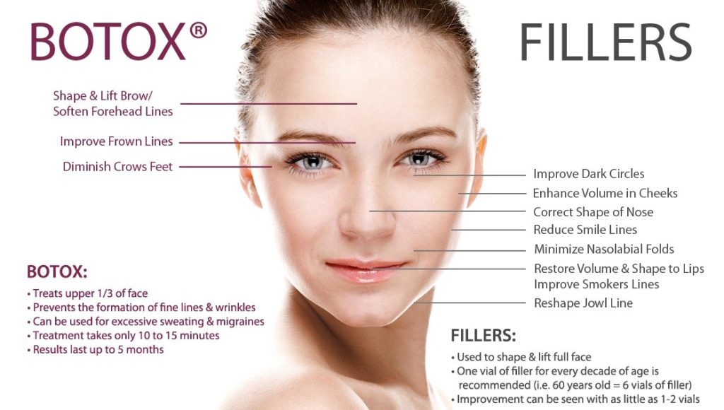 botox and dermal fillers