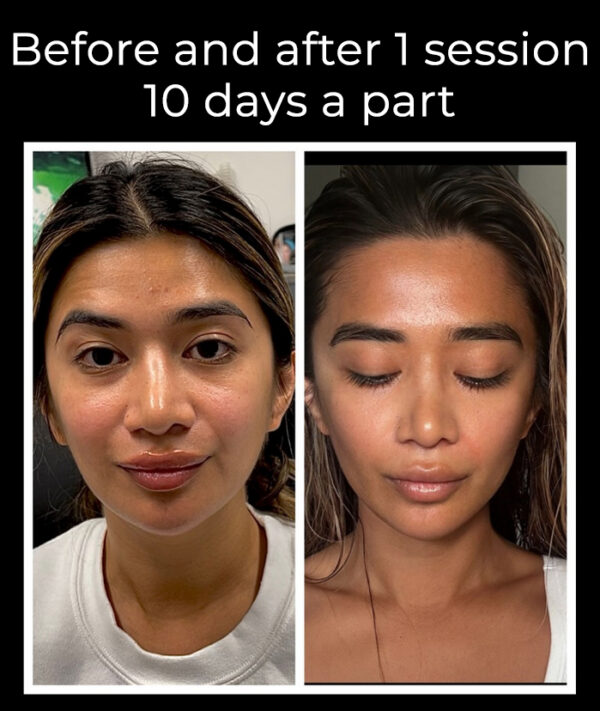 Exo-NAD Longevity Peel – Laval - Image 2