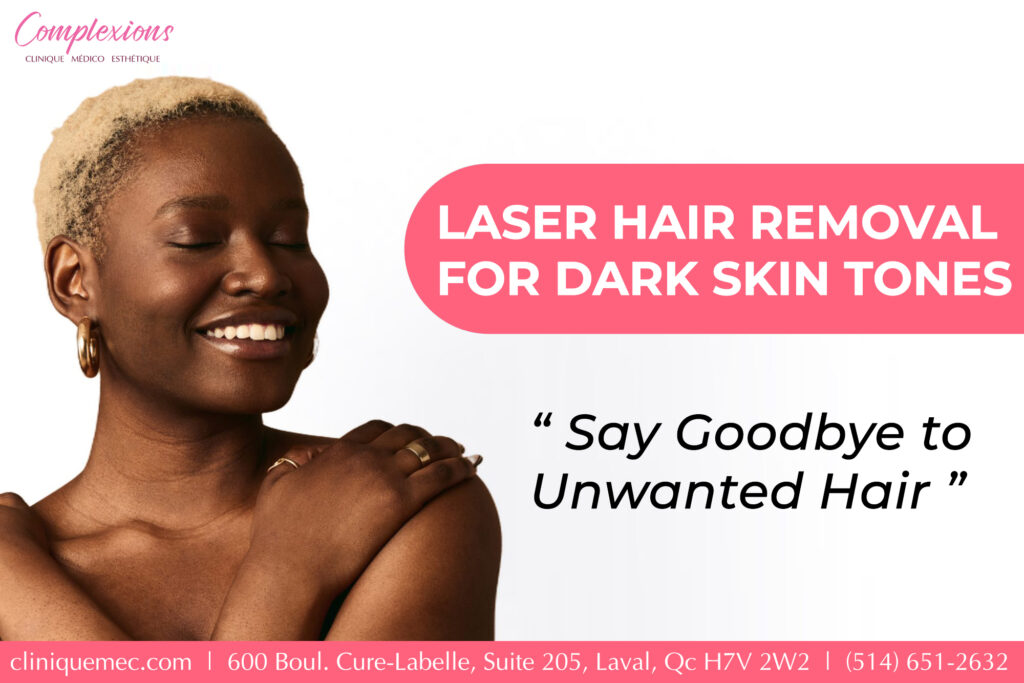 Laser hair removal guide Laval clinic