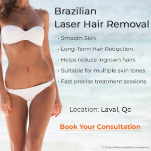 brazilian laser hair removal treatment in laval for long term hair reduction