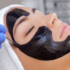 V Carbon Peel treatment Laval