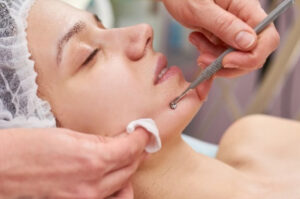 traitement-clarifiant-avec-extractions-soin-du-visage-laval